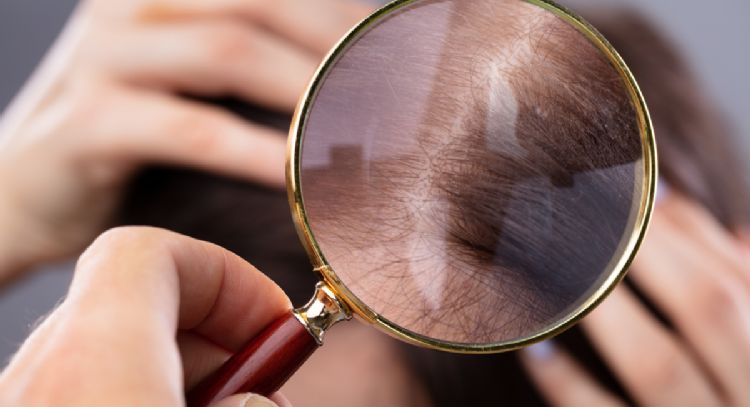 Despídete de las canas, descubre los aceites esenciales perfectos para eliminarlas