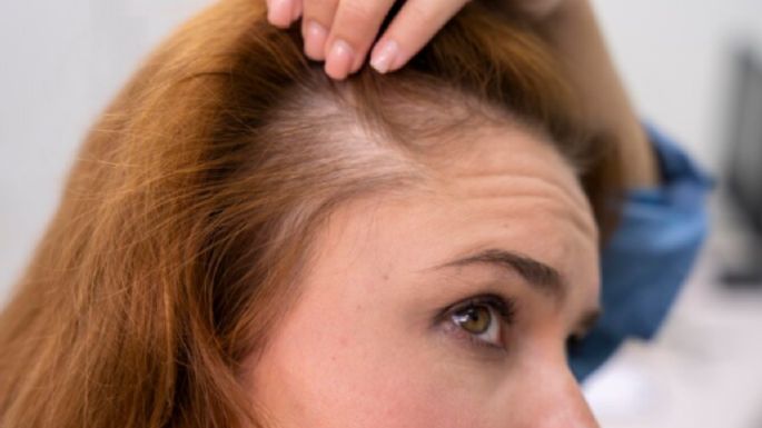 ¿Por qué tienes canas antes de los 30? los expertos lo explican