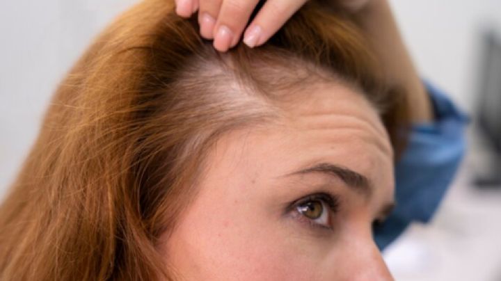 ¿Por qué tienes canas antes de los 30? los expertos lo explican